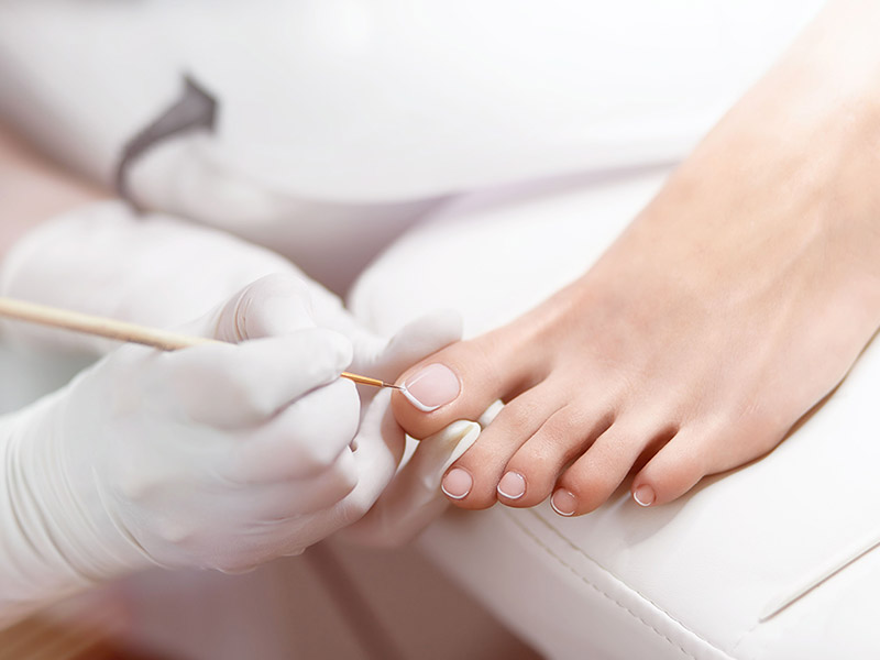 Pedicure